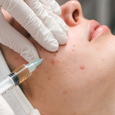 pimple1.jpg